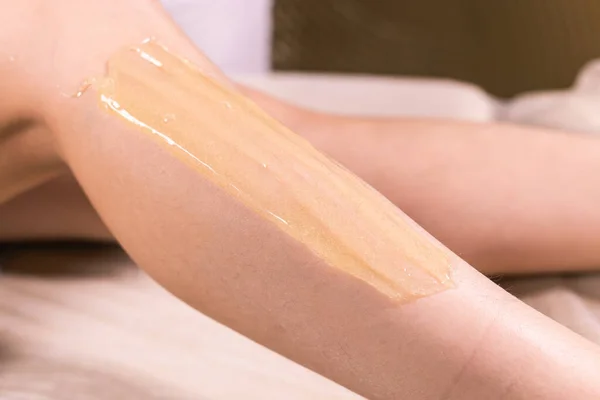 Sugaring processing, epilation with liquate sugar at legs, close-up. Beauty and cosmetology concept.