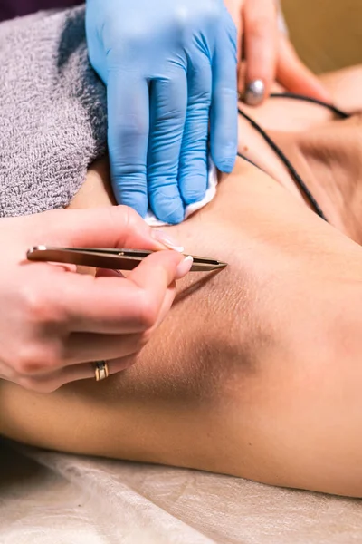 Close-up van het verwijderen van okselhaar met pincet. Vrouwelijke ontharing. Cosmetologie en schoonheidssalon concept. Rechtenvrije Stockafbeeldingen