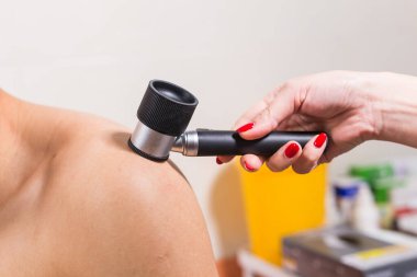 Deri lezyonları ve benlerin dermoskopi yöntemi. Melanoma ve Cilt Kanseri Önleniyor