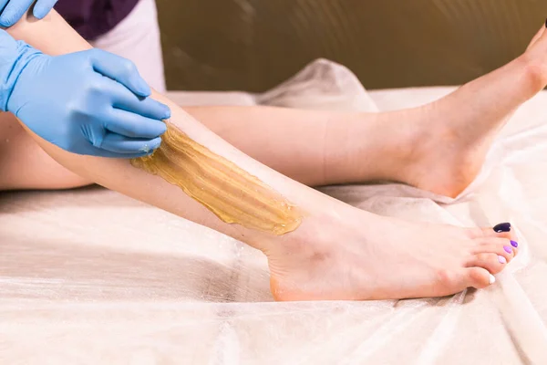 Sugaring epilation with liquid sugar at legs close-up. Cosmetology and beauty concept.