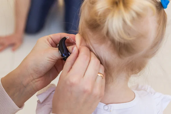 Hoortoestel in baby meisjes oor. Peuter kind draagt een gehoorapparaat thuis. Gehandicapte kinderen, handicaps en doofheid. — Stockfoto