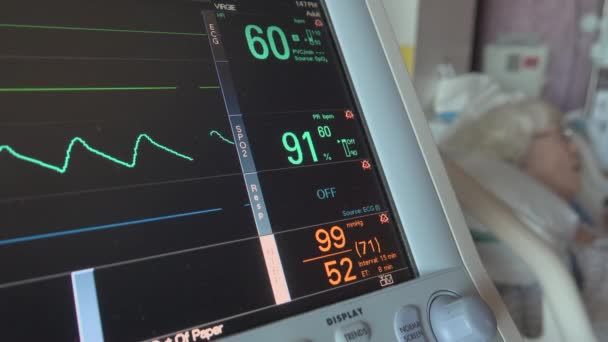 Dolly tiro de monitor médico no hospital — Vídeo de Stock