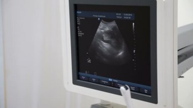 Ultrason hastanın monitör, video resim
