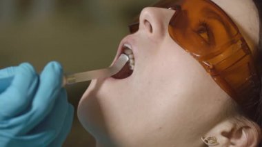 Kadın hasta Başlarken tedavi diş Uv ışık cihazları ile yukarı perdesi. Diş office.