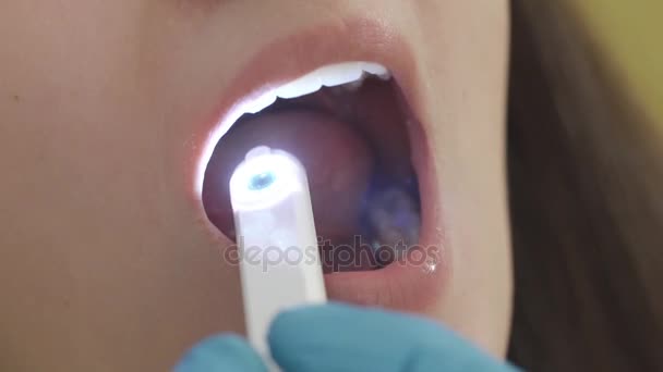 Primo piano, dentista che esamina la bocca di un paziente con una telecamera intraorale . — Video Stock