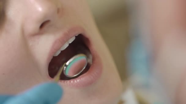 检查口腔和牙齿。在口腔检查病人的年轻女孩张开嘴的特写镜头 — 图库视频影像