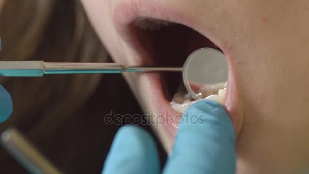 检查口腔和牙齿。在口腔检查病人的年轻女孩张开嘴的特写镜头. — 图库视频影像