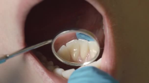 Examen de la boca y los dientes. Primer plano de la joven paciente boca abierta durante el chequeo oral . — Vídeo de stock