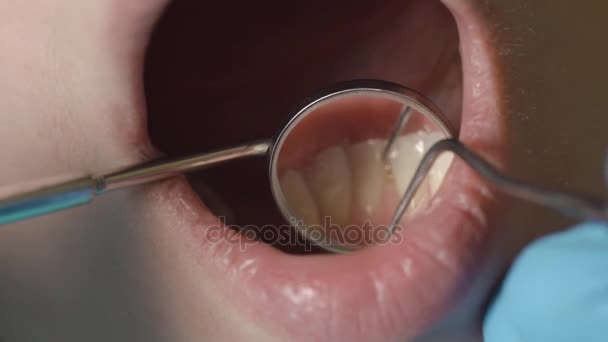 Examen de la bouche et des dents. Gros plan de la jeune fille patiente bouche ouverte lors d'un examen oral — Video