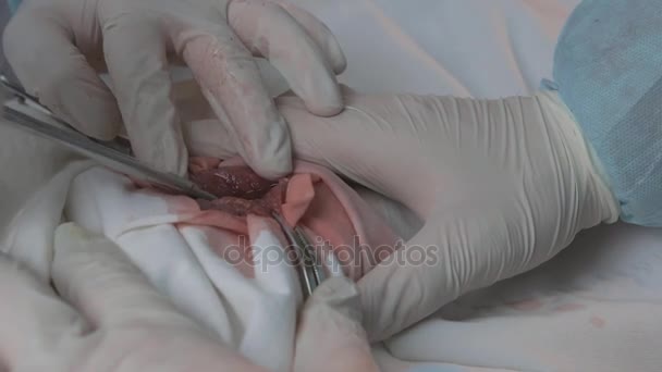 Opération chirurgicale à l'aide d'outils chirurgicaux. Mains avec des gants chirurgicaux. Équipe chirurgicale opérant dans la salle d'opération de l'hôpital, médecins faisant une coupure sanglante avec scalpel. Chirurgie sur clinique . — Video