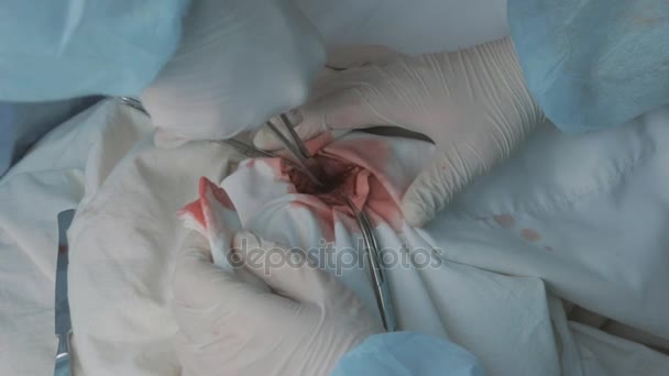 做外科手术使用外科手术工具。外科手术手套的双手。执行操作在医院的手术室，医生在做出血腥的手术团队用手术刀切。手术在临床上. — 图库视频影像