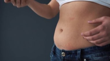 Kadın ölçü kolan hamburger karşı onun oryantal kilolu. Lokanta overeating, zehirlenme kavramı