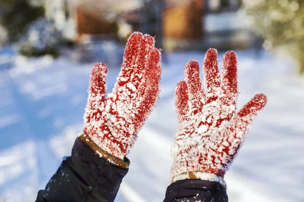 Female shows  hands with snowy gloves