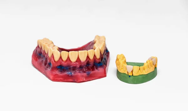 Технические снимки моделей на стоматологической лаборатории — стоковое фото