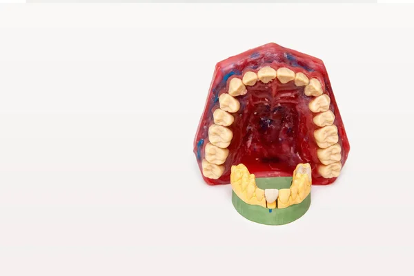 Технические снимки моделей на стоматологической лаборатории — стоковое фото