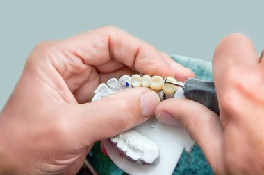 Diş prothetic laboratuvar teknik çekim 