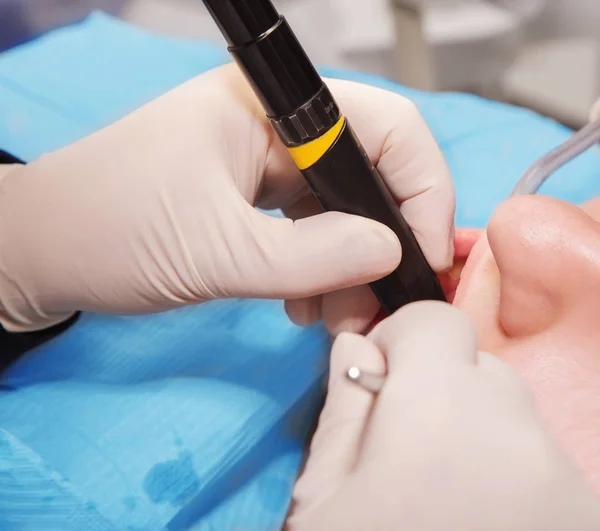 Tandläkare att göra patientens tänder hygien — Stockfoto
