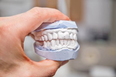 Diş prothetic laboratuvar teknik çekim 