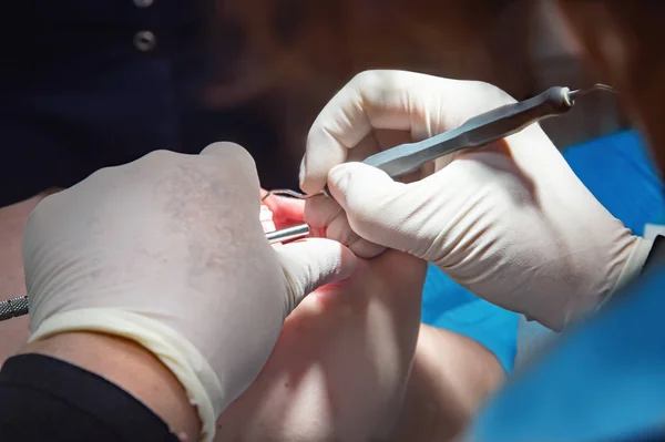 Οδοντίατρος κάνει υγιεινή δοντιών του ασθενούς — Φωτογραφία Αρχείου