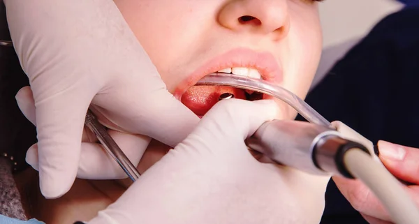 Dentysta Dokonywanie higieny zębów pacjenta — Zdjęcie stockowe