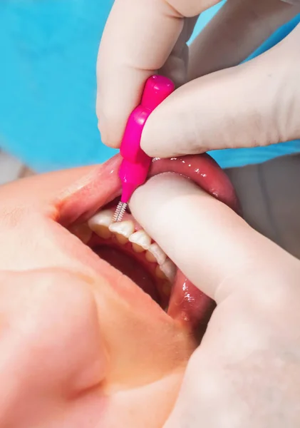 Tandläkare att göra munhygien med mellanrumsborste — Stockfoto
