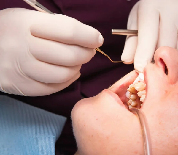 Tandläkare att göra patientens tänder hygien — Stockfoto