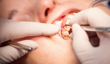 Dişçi el bir araç ve bir hasta ile