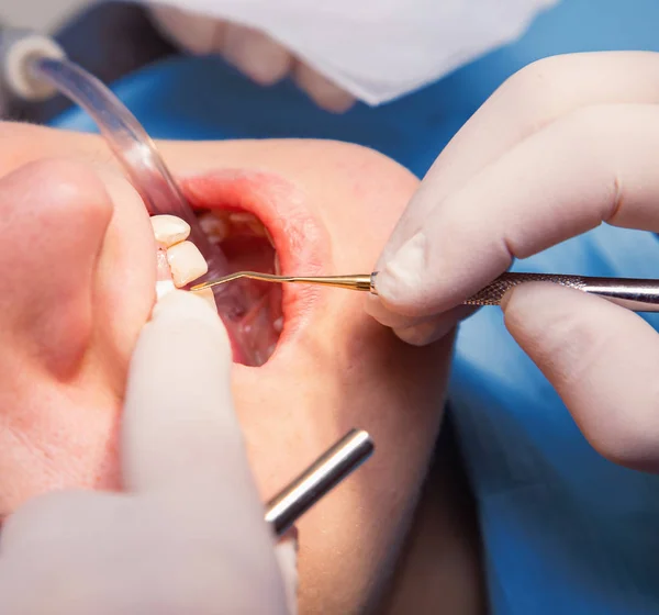 Gabinet stomatologiczny ręce narzędzie i pacjenta — Zdjęcie stockowe