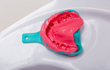 Silicone dental imprint clipart