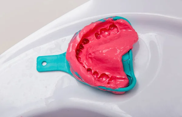 Silicone dental imprint — Stock Photo, Image