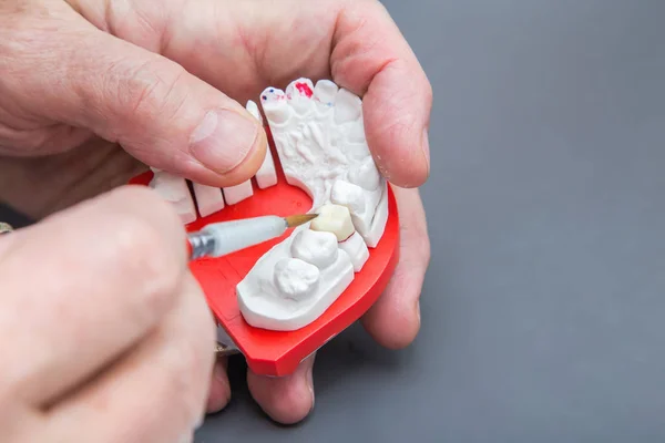 Manos de dentista con pincel trabajando en modelo dental cerámico . — Foto de Stock