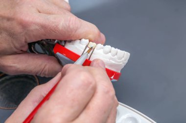 Diş hekimi eller fırça seramik diş model üzerinde çalışma ile.