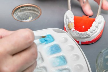 Diş hekimi eller fırça seramik diş model üzerinde çalışma ile.