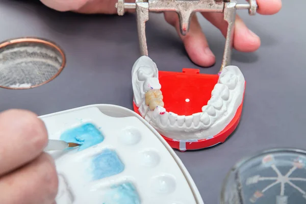 Dentysta ręce z pędzla pracy modelu dental ceramiczne. — Zdjęcie stockowe