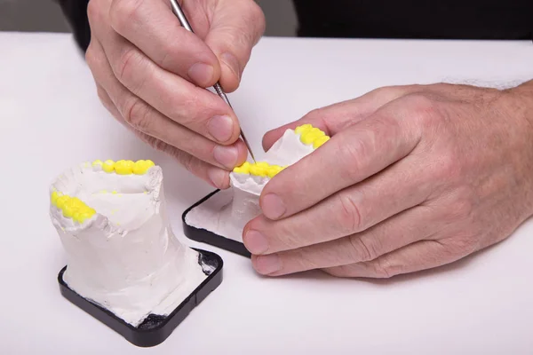 Fotografias técnicas do modelo num laboratório de prótese dentária — Fotografia de Stock