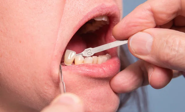 Dentysta, sprawdzanie i wybierając kolor zębów kobiety — Zdjęcie stockowe