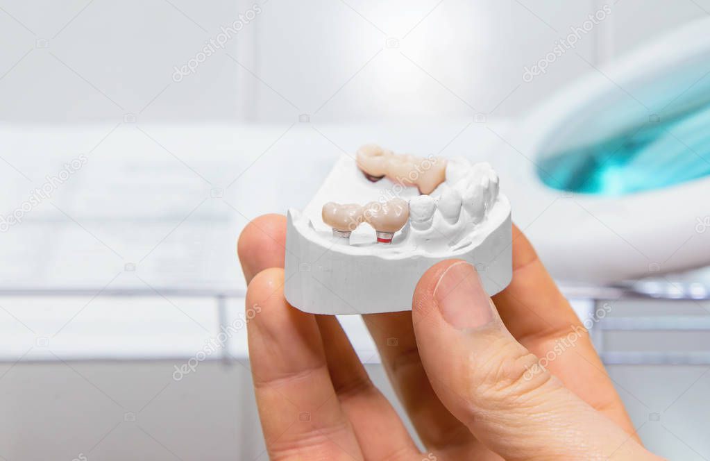 Technical shots of model on a dental prothetic laboratory 