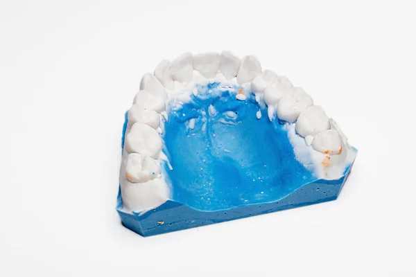 Dental impression on white — Stock Photo, Image