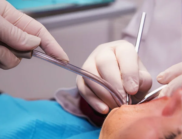 Tandläkarens händer med verktyg att göra hygien i patientens mun — Stockfoto