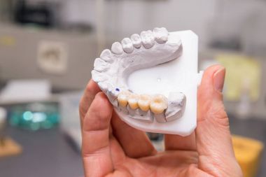 Diş prothetic laboratuar modeli teknik çekim