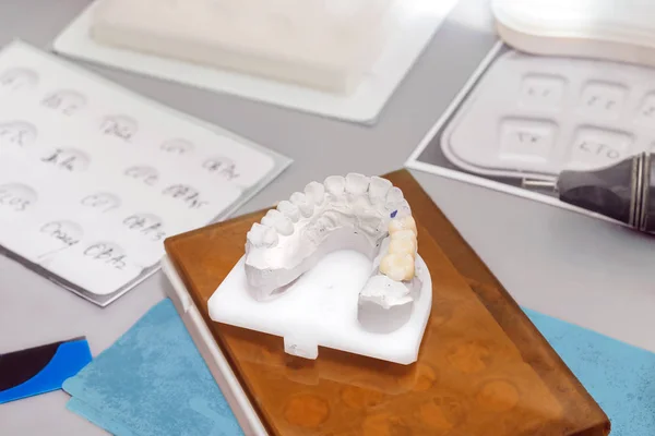 Gips-Zahnmodell mit keramischen Zähnen — Stockfoto