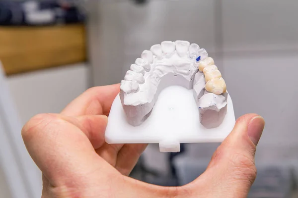 Inyecciones técnicas de modelo en un laboratorio protésico dental — Foto de Stock