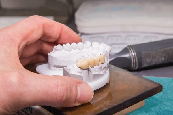 Fotografie tecniche di un modello su un laboratorio di protesi dentale — Foto Stock