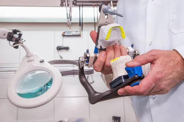 Τα χέρια του οδοντιάτρου με μοντέλο σε ένα οδοντοτεχνικό εργαστήριο prothetic — Φωτογραφία Αρχείου