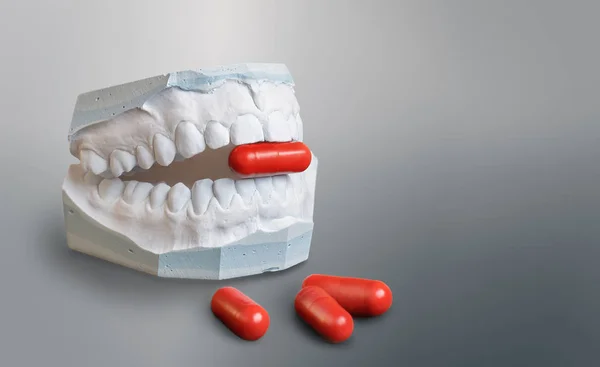 Gypsum teeth model holding   a red medicine capsule — Stock Photo, Image