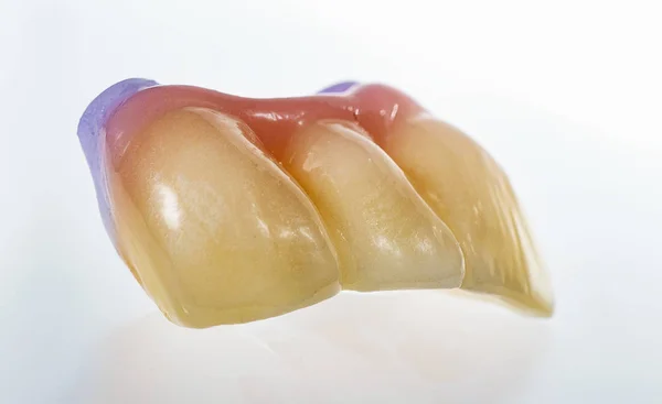 Технические снимки зубного протеза на зубопротезном половом губе — стоковое фото