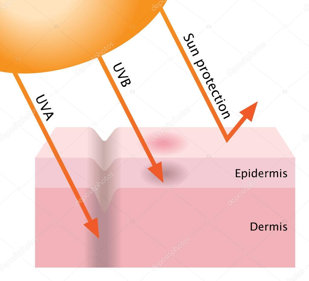 infographic skin illustration. UVA and UVB penetration into the human skin. sunscreen protect the skin from radiation.