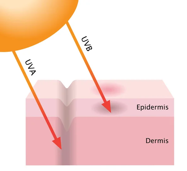 La radiación UVA y UVB penetra en la piel — Vector de stock