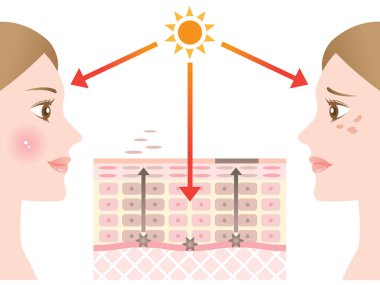 Cilt nokta mekanizması