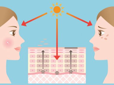 Cilt nokta mekanizması